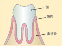 歯周病の進行